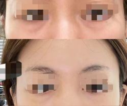 -郡艺医疗美容·微整·眼鼻吸脂