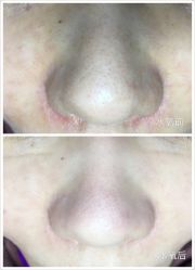 水氧-光SPA科技美肤