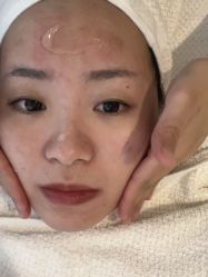 -JNK皮肤管理中心