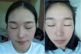 -SKINIST丽铂医疗美容