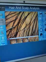 -熙朵美学植发·连锁品牌