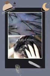 -顶尚堂白发脱发养发