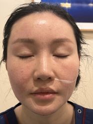 -北京米扬丽格医疗美容·联合丽格鼻整形中心