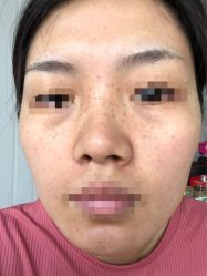 -西安现代妇产医院医疗美容