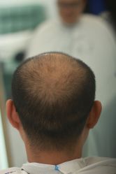 -发饰美男士增发补发假发定制店