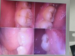 -土豆口腔(凤凰北总店)