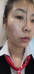 体验后-上海宏康医院·医疗美容科