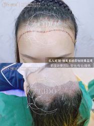 -熙朵美学植发·连锁品牌