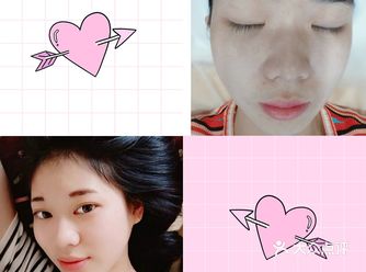 想体验小气泡很久了～抽了个空去了JENNY医美～哎呦