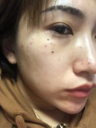 -上海玫瑰医疗美容医院