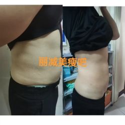 -丽减美瘦吧·减肥瘦身