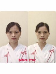 -SEAS小顏·日本小颜整骨美容サロン