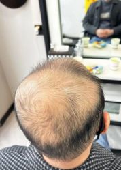 -唐风采假发补发定制