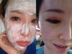 -More摩尔医美の注射线雕光电中心