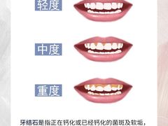 -茂菊口腔连锁(浦东南路店)