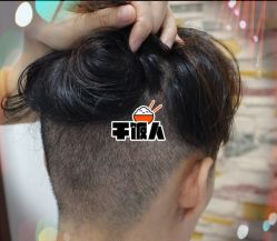 -大麦微针植发全国连锁