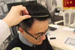 点击看大图 -大麦微针植发丨全国连锁