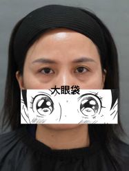 -天津健丽·去眼袋医疗美容机构