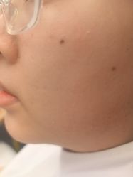 -长沙雅美医疗美容医院