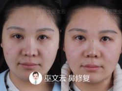 -北京米扬丽格医疗美容·联合丽格鼻整形中心