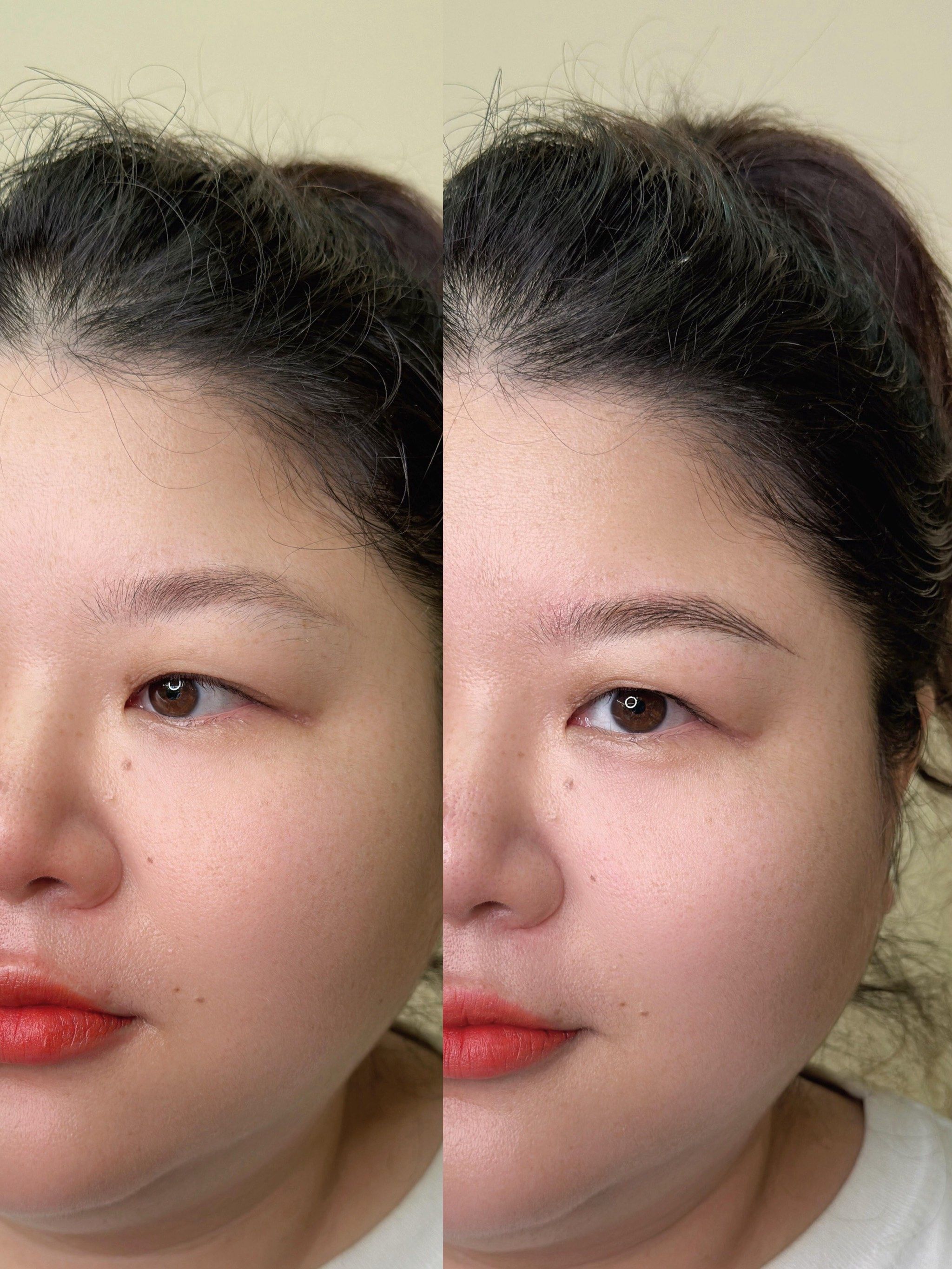 为什么没有眉毛 为什么没有眉毛