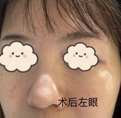 体验后-深圳鹏爱秀琪医疗美容医院