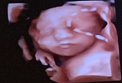 -杭州贝瑞斯美华妇儿医院·早孕·产检·儿科