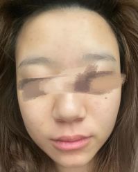 点击看大图 -ROYEA茹彦祛痘·问题肌肤修护中心