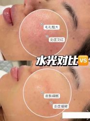 -LUNA皮相美·骨相美高级美感