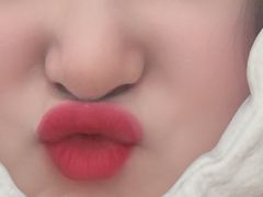 -黑马眼科·近视手术