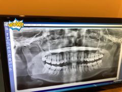 -天使口腔门诊部(上海店)