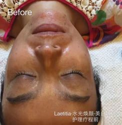-凝舍科技美容中心