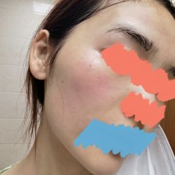 点击看大图 体验后-温州伯思立医院