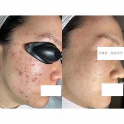 -美肤盾祛痘·问题肌头疗管理中心