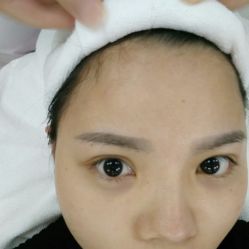 体验前-深圳春天阳光医院·轮廓抗衰中心