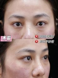 -Yestar重庆艺星医疗美容医院