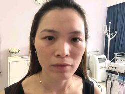 点击看大图 -美莱医疗美容医院