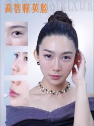-深圳艺星医疗美容医院
