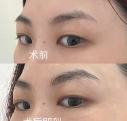 -杭州医巢医疗美容