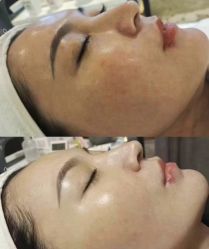 点击看大图 -SKIN79皮肤管理中心
