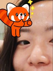 -北京米扬丽格医疗美容·联合丽格鼻整形中心