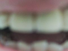 -极光口腔·矫正种植修复(锦江院区)