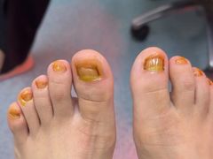 -新甲连锁灰指甲·甲沟炎·鸡眼(黑龙江路店)