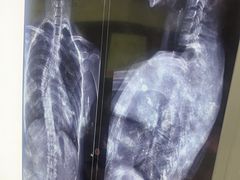 -张钰强中医正骨推拿连锁(华发商都店)
