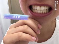-欢乐口腔(望京分院)