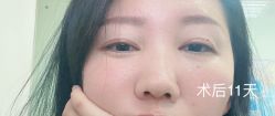 体验后-天津伊美尔医疗整形美容专科医院