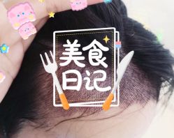 -大麦微针植发全国连锁