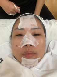 -苗方清颜专业祛痘连锁机构