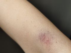 -瑞慈体检上海松江机构