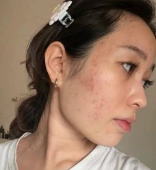 -Yestar艺星医疗美容医院